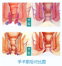 �̴������Ա�ͼ